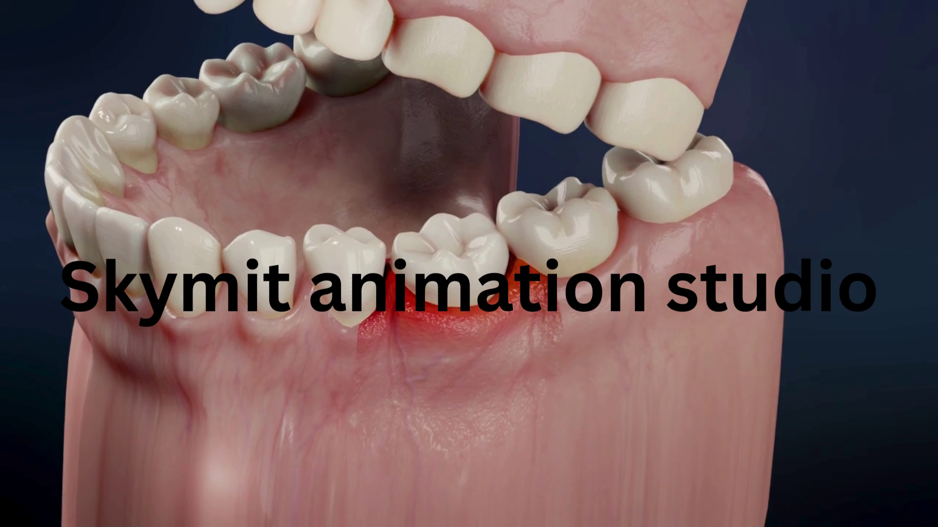 3D dental animation-1